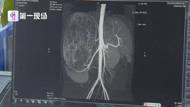 皇冠信用網在线申请_17岁女孩确诊癌症皇冠信用網在线申请！买衣服时店员看出端倪……这个细节很重要！