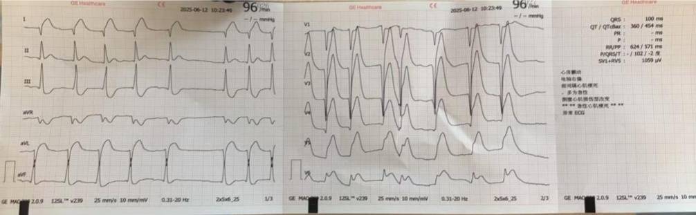 足球平台代理怎么做_一次亲热足球平台代理怎么做！杭州男子差点没命！这种凶险急症梅雨天高发