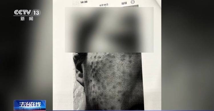 皇冠信用网代理占成
_打美容针竟致十级伤残皇冠信用网代理占成
!在医生家中做医美 出了事谁负责?