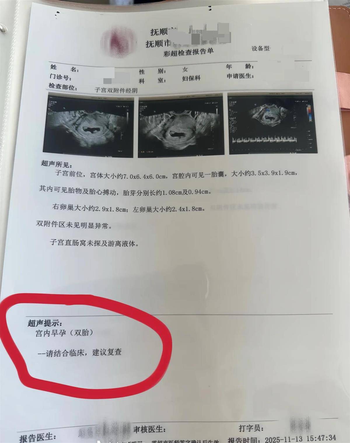 皇冠足球平台_辽宁一孕妇两个月内从一胎变四胞胎皇冠足球平台，每次产检发现多出一胎，医生：系同卵四胞胎，概率1300万至1500万分之一