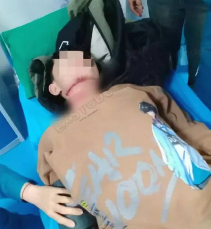 皇冠信用网登2_河南13岁被锁喉男孩赴京治疗后已脱离生命危险皇冠信用网登2，拉绳老人已被采取刑事强制措施