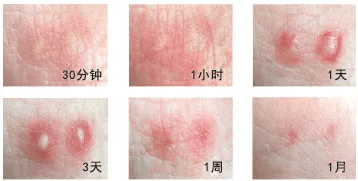 皇冠信用网怎么弄_“五一假期”外出看见这种小土包皇冠信用网怎么弄，千万别踩！