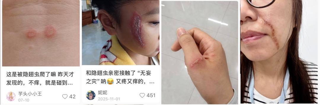 皇冠信用
_北京已有人中招皇冠信用
,千万不能拍,毒液堪比硫酸,会毁容——
